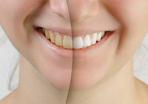 40代 女性のお客様の声に添えられた写真